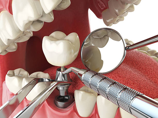 Best Emergency Cosmetic Dentistry (e.g., broken veneers) in Wildwood, TN